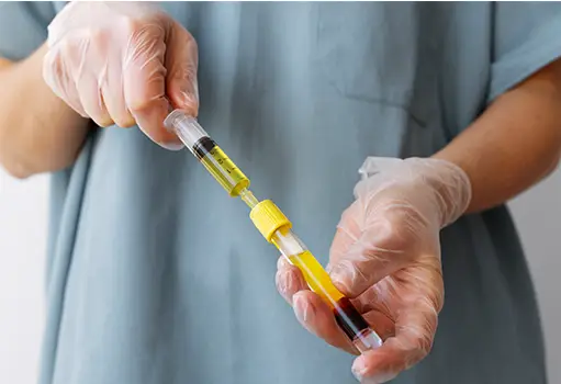 PRP (Platelet-Rich Plasma)