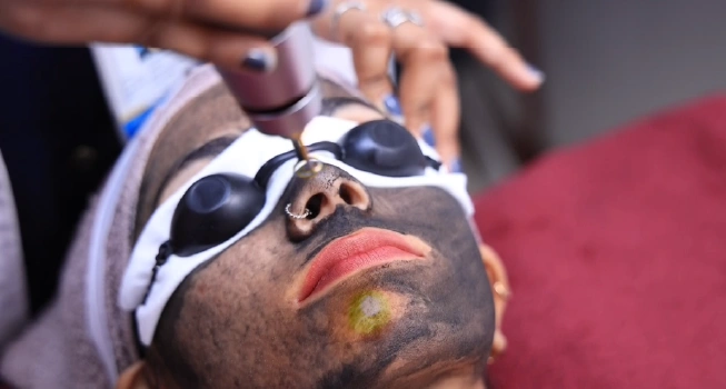 Q Switch Laser Procedure
