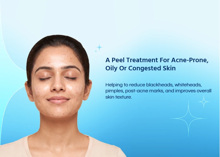 Salicylic Peel Treatment