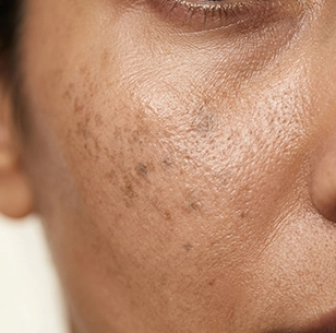 Brown or grayish spots
