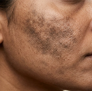 Discoloration that doesn’t fade over time