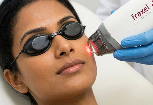 Q-Switch Laser Pigmentation Treatment