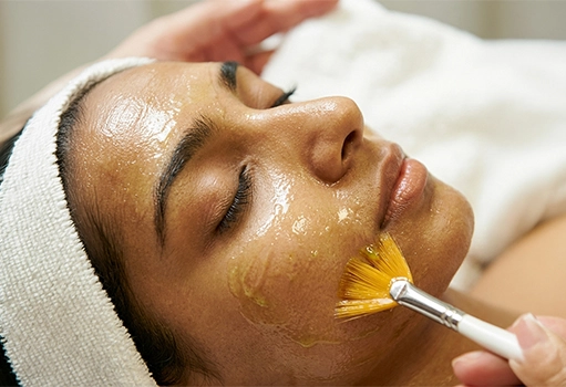 Yellow Peel Treatment