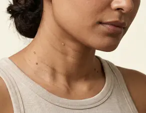 Friction and skin rubbing