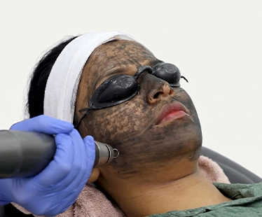 Laser Skin Lightening