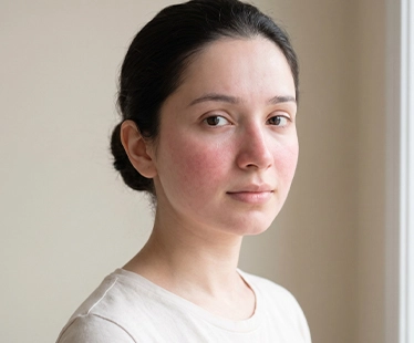 Skin Type I – Very Fair Skin