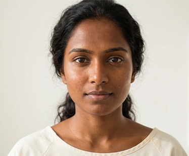 Skin Type V – Brown Skin