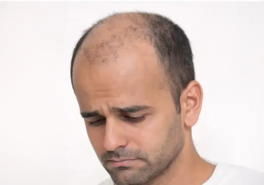 Stage 4