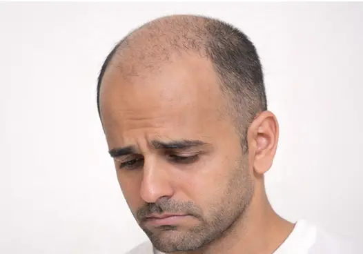 Stage 5