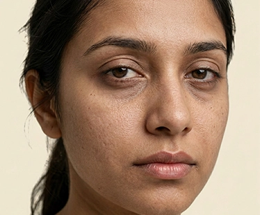 Tired-Looking Skin