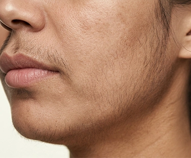 Facial Hair