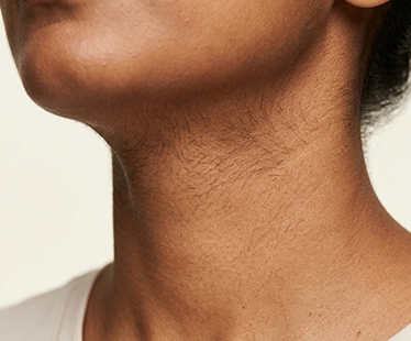Neck Hair
