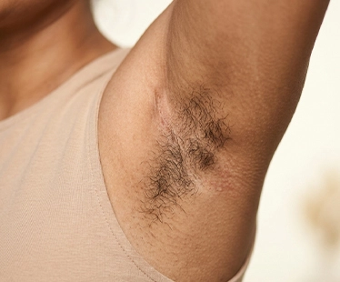 Underarm Hair
