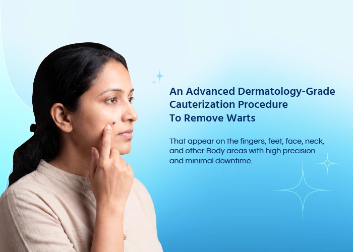 Wart Removal Treatment