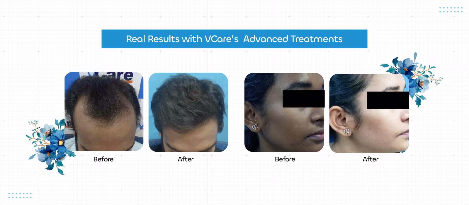 hair and skin treatment
            