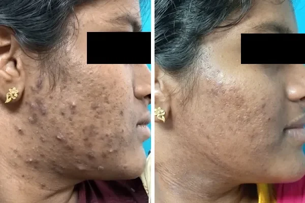 Rejuvenate & Repair Dull skin